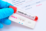 covid 19 coronavirus